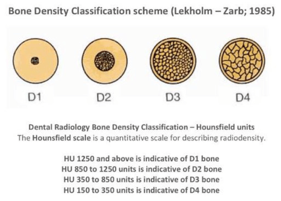 clasificación densidad hueso